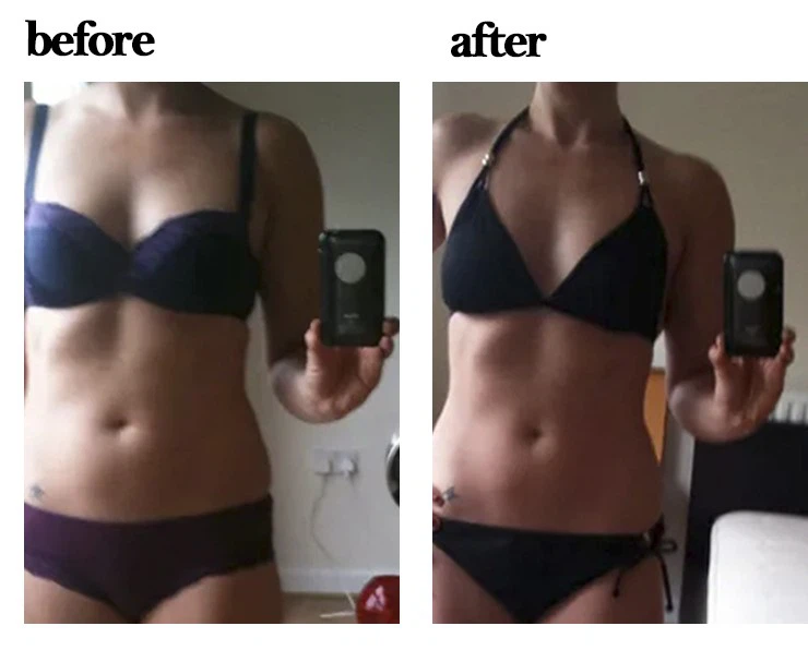 Waist Trainer Before and After Waist Trainer Before and After